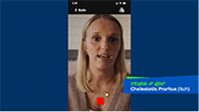 Abby: speaking up about cholestatic pruritus