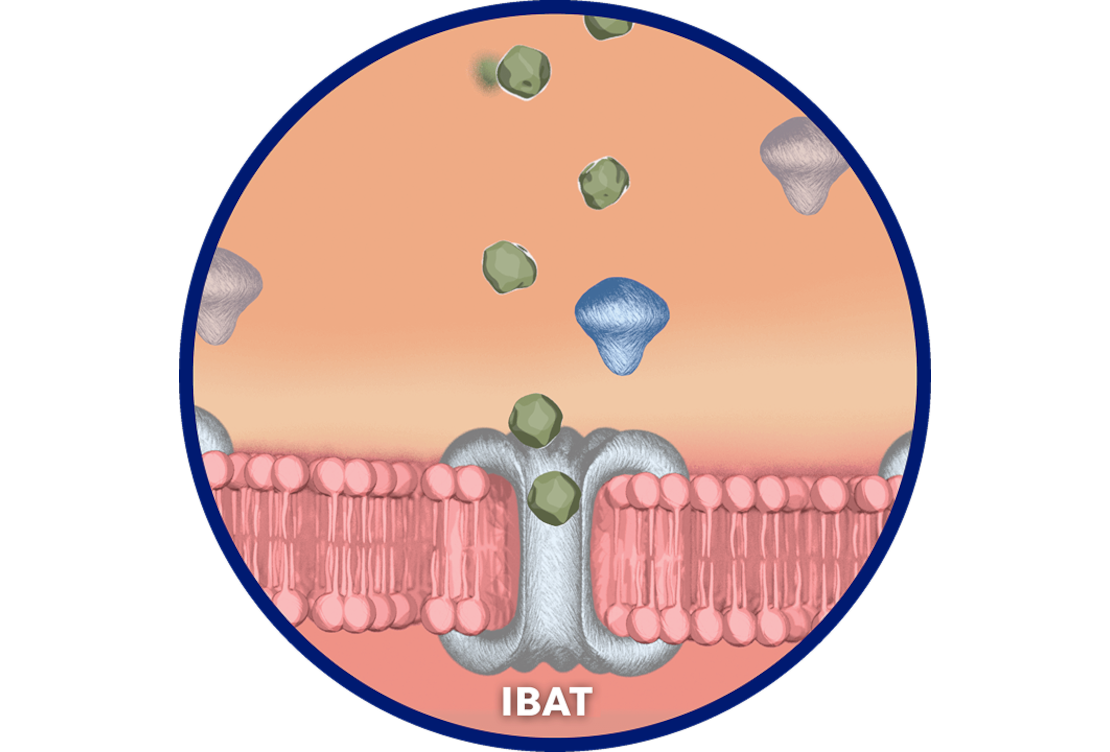 An illustration of IBAT.