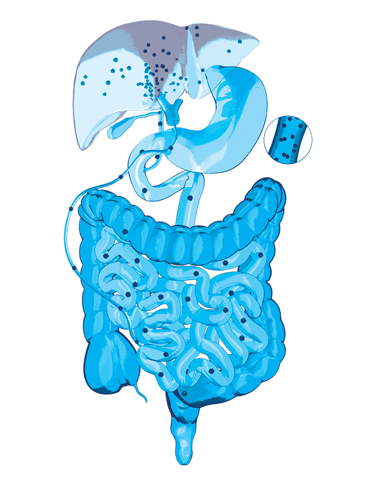 An illustration of bile acids building up in the liver.