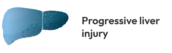 A blue liver gradually turning darker illustrating injury due to elevated bile acid.